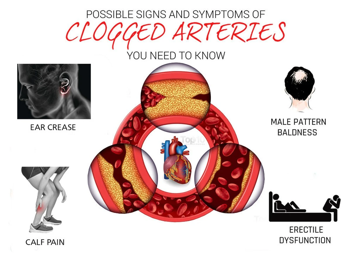 dlaczegodoswiad-extra-1.webp Dlaczego doświadczeni kardiolodzy radzą dodawać łyżkę oliwy do wody z cytryną - image 1