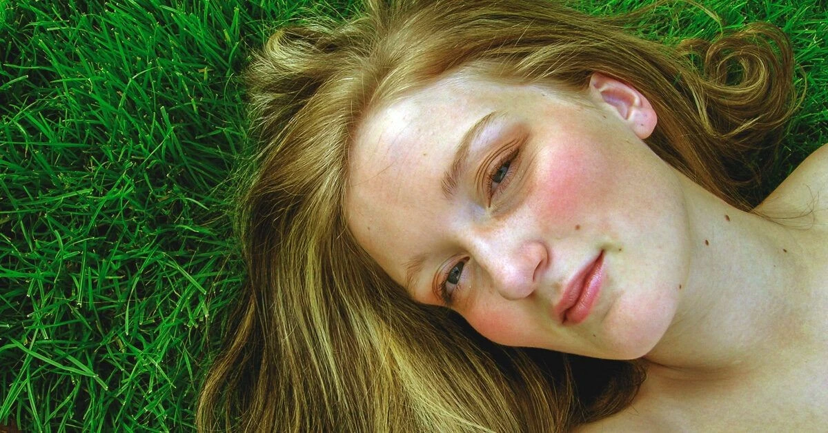 Dlaczego Twoje policzki nagle płoną: to nie jest zwykły rumień - image 1