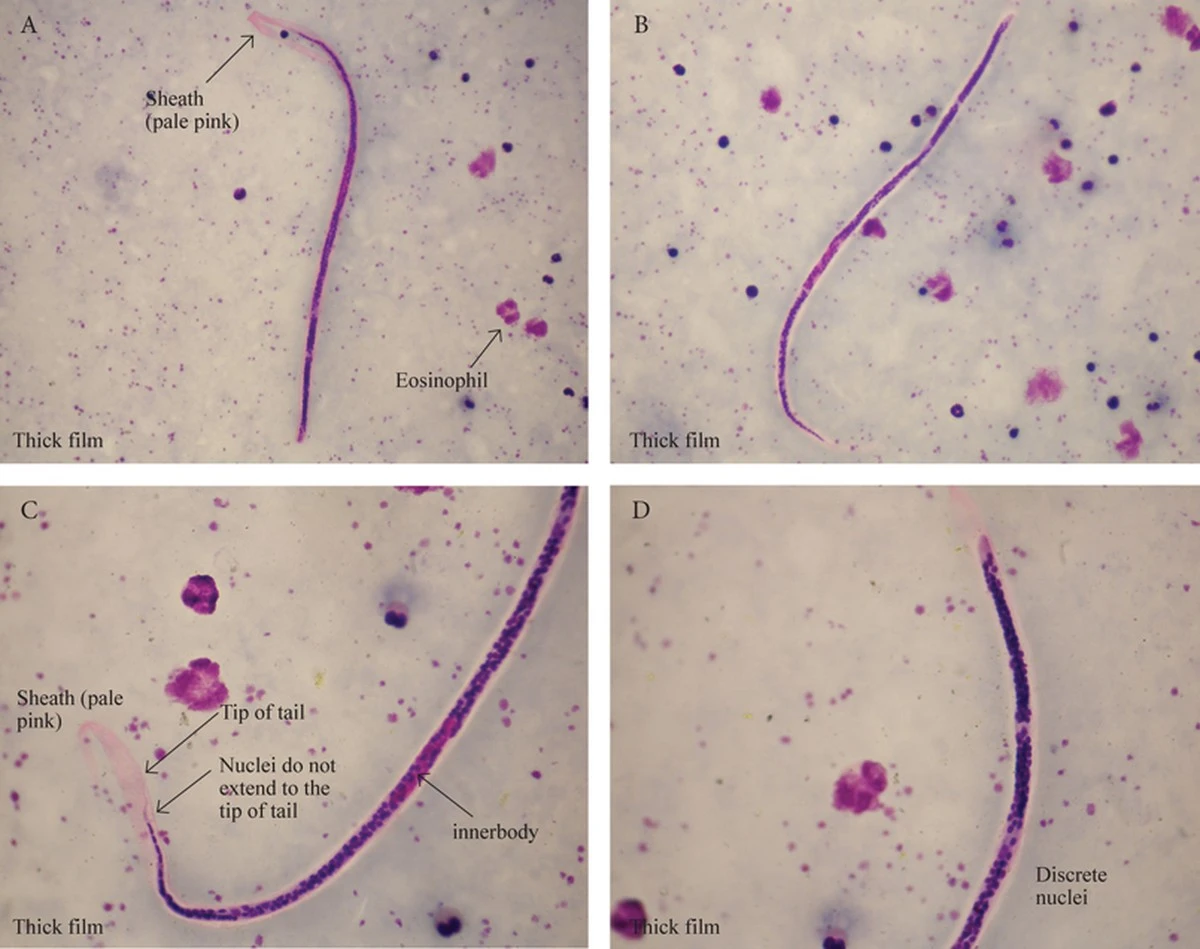 Dlaczego lekarz pyta o „gości” w brzuchu, gdy czujesz zmęczenie - image 1